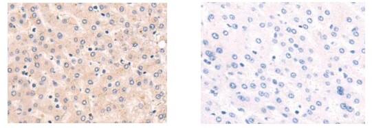 PIM3 Antibody[37701]