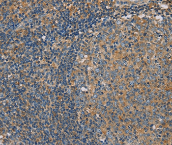 CLIC1 Antibody[36633]