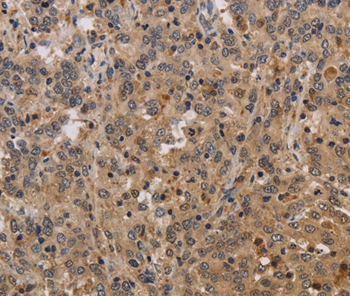 ELAVL2 Antibody[37685]