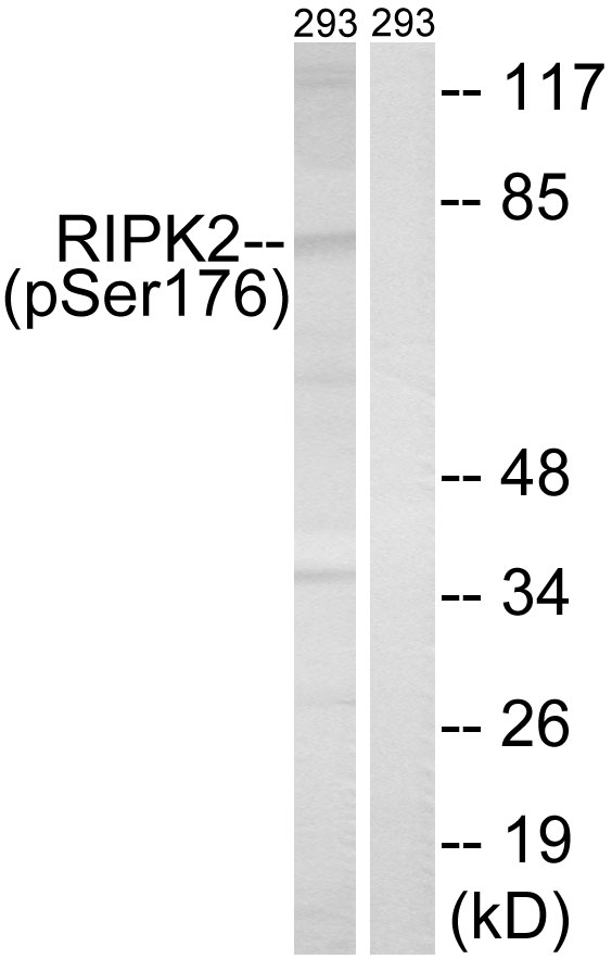 RIPK2 (Phospho-Ser176) Antibod