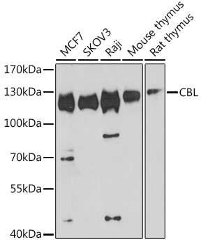 CBL Rabbit Polyclonal Antibody
