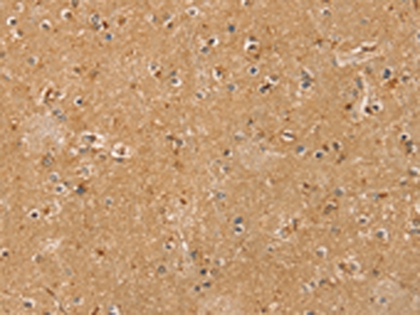 RASSF1 Antibody[42729]