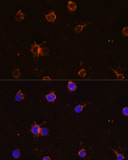 ITGAM antibody[38258]