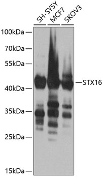 STX16 Rabbit Polyclonal Antibo