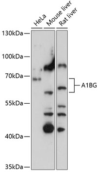 A1BG Rabbit Polyclonal Antibod