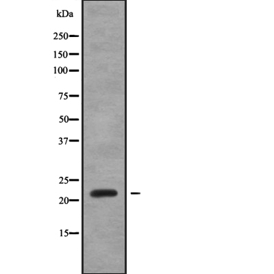 SAR1A Antibody[46001]