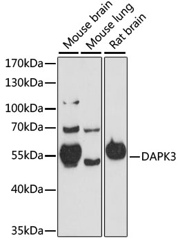 DAPK3 Polyclonal Antibody[2919