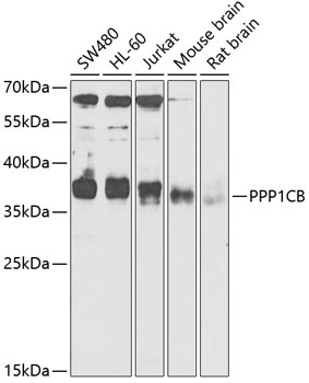 PPP1CB Rabbit Polyclonal Antib