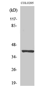 PKAα/β cat Polyclonal Antibody