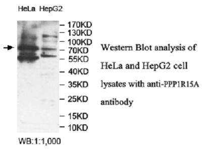 PPP1R15A Antibody[39948]
