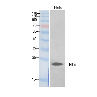 Neurotensin Polyclonal Antibod