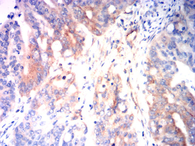 CD126 Mouse mAb[63237]