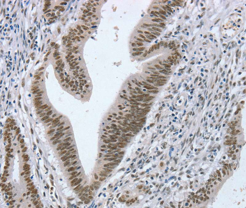 RNF20 Antibody[40080]