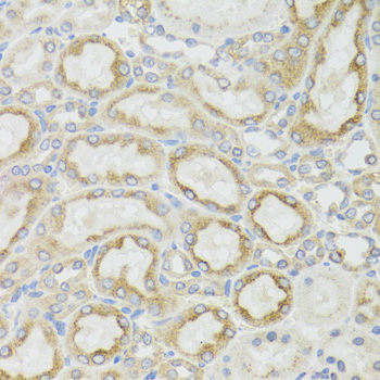 MT-ND5 Rabbit Polyclonal Antib