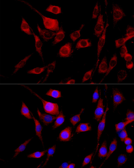 FGFR2 Rabbit Polyclonal Antibo