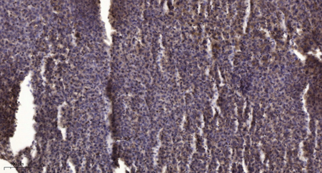 PHF5A rabbit pAb[44277]