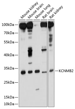 KCNMB2 Rabbit Polyclonal Antib