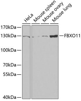 FBXO11 antibody[38737]