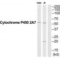 CYP2A7 Antibody[35266]