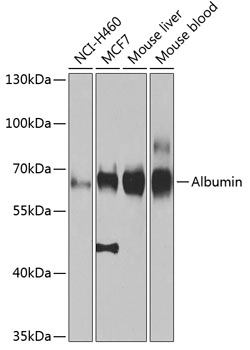 Albumin Rabbit Polyclonal Anti