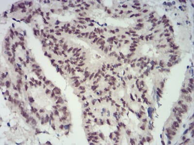 CBX4 Mouse mAb[63196]