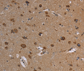 REG3A Antibody[37727]