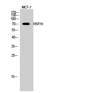 HSP70 Polyclonal Antibody[4104