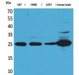 UCH-L1 Polyclonal Antibody[415