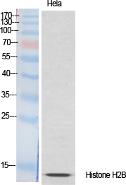 Histone H2B Polyclonal Antibod