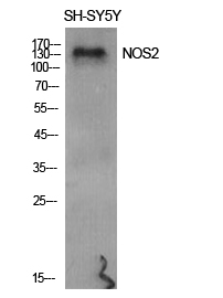 NOS2 Polyclonal Antibody[41249