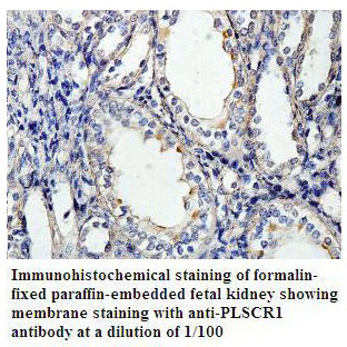 PLSCR1 Antibody[39803]