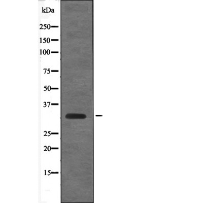 Cyclin D1 (Phospho-Thr288) Ant