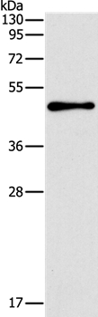 TFAP2B Antibody[37333]