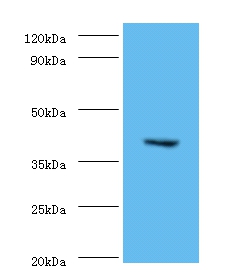 CMP-N-acetylneuraminate-beta-1