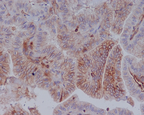 MHC class 1 Rabbit mAb[56034]