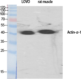 Actin α1 Polyclonal Antibody[4
