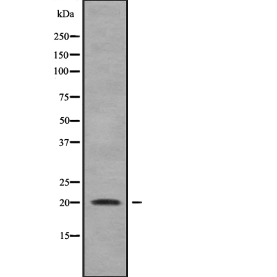 IMMP2L Antibody[46048]