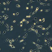 浙江（杭州）美森人淋巴内皮细胞Human Lymphatic Endothelial Cells(HLEC)现货