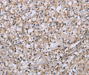 DTNB Antibody[36425]