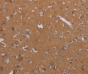 MAGEB10 Antibody[36596]