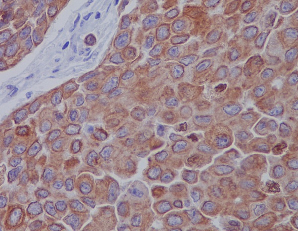 Mitofusin 2 Rabbit mAb[56132]