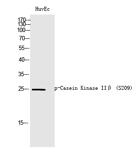 Casein Kinase IIβ (Phospho-Ser