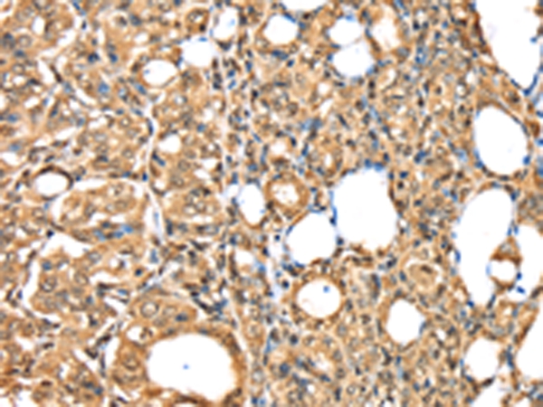 PSMB8 Antibody[43134]