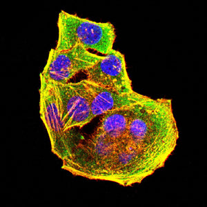 C5AR2 Mouse mAb[63179]