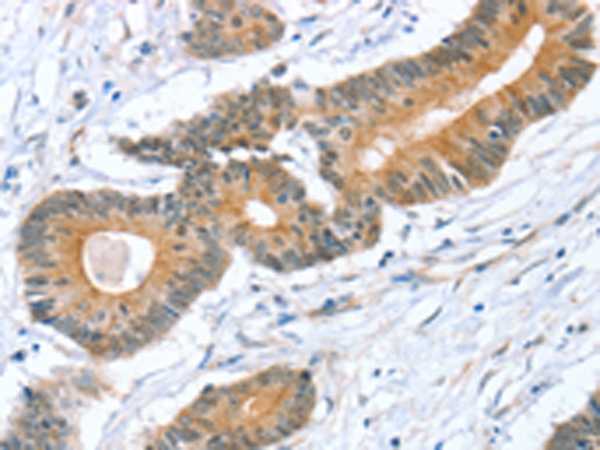 STXBP1 Antibody[43334]
