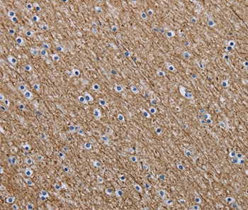 NEFM Antibody[37760]