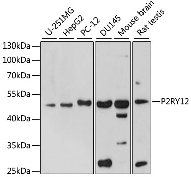 P2RY12 Rabbit Polyclonal Antib