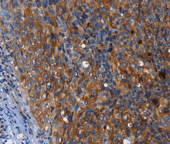 MSLN Antibody[35823]