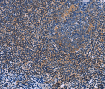 AGFG1 Antibody[36061]