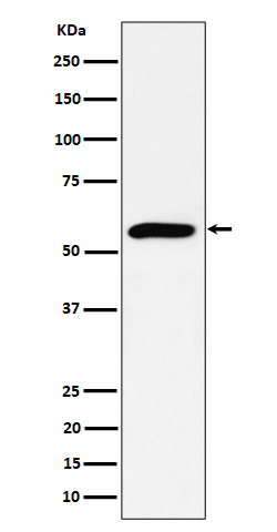 PRPF4 Rabbit mAb[57128]